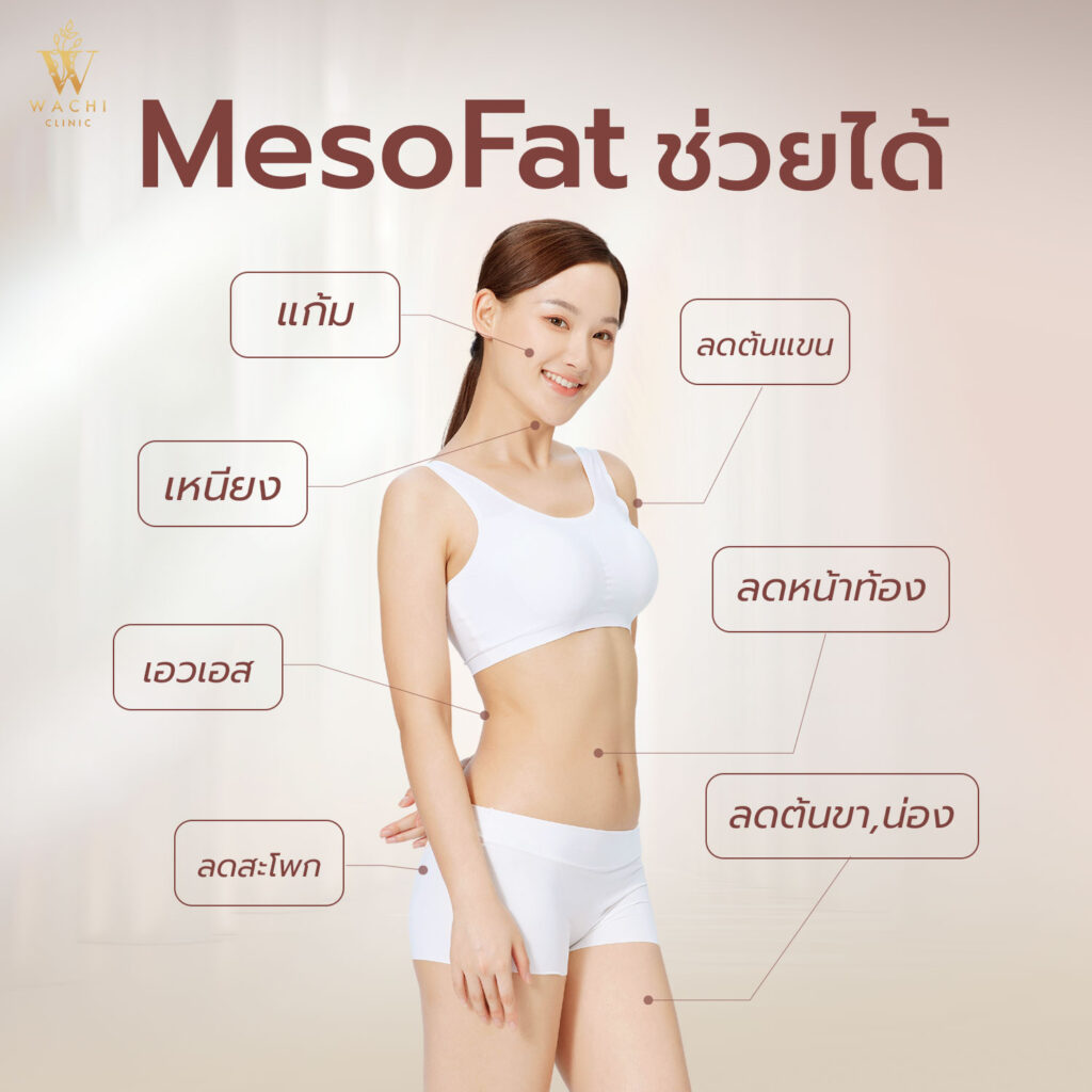 เมโสแฟต โปรแกรม
