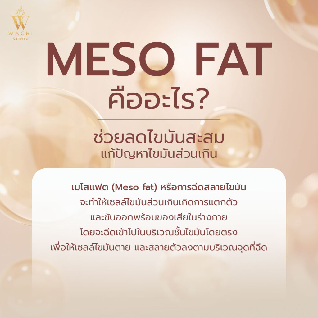 เมโสแฟต-คืออะไร