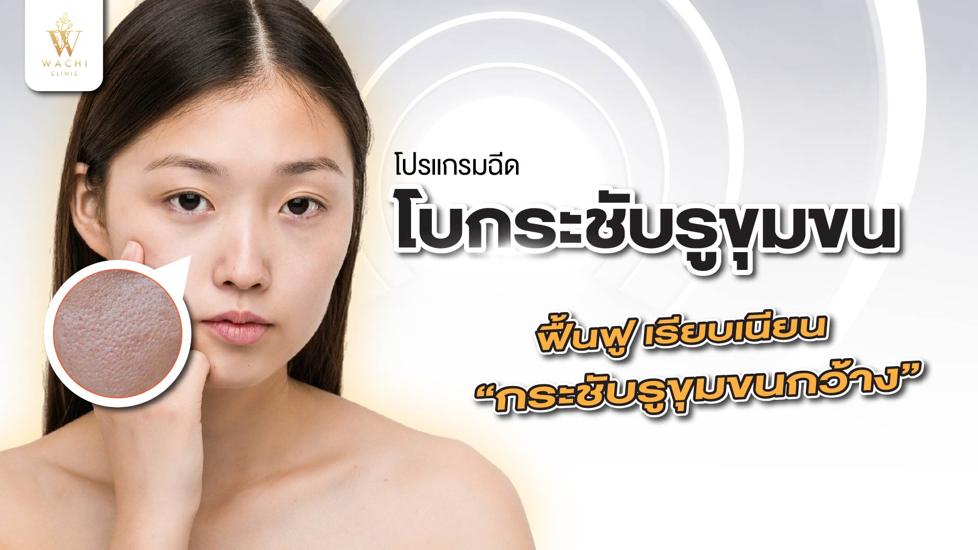 โบกระชับรูขุมขน ฟื้นฟู เรียบเนียน กระชับรูขุมขนกว้าง