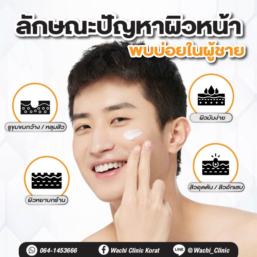 ปัญหาผิวหน้าของผู้ชาย