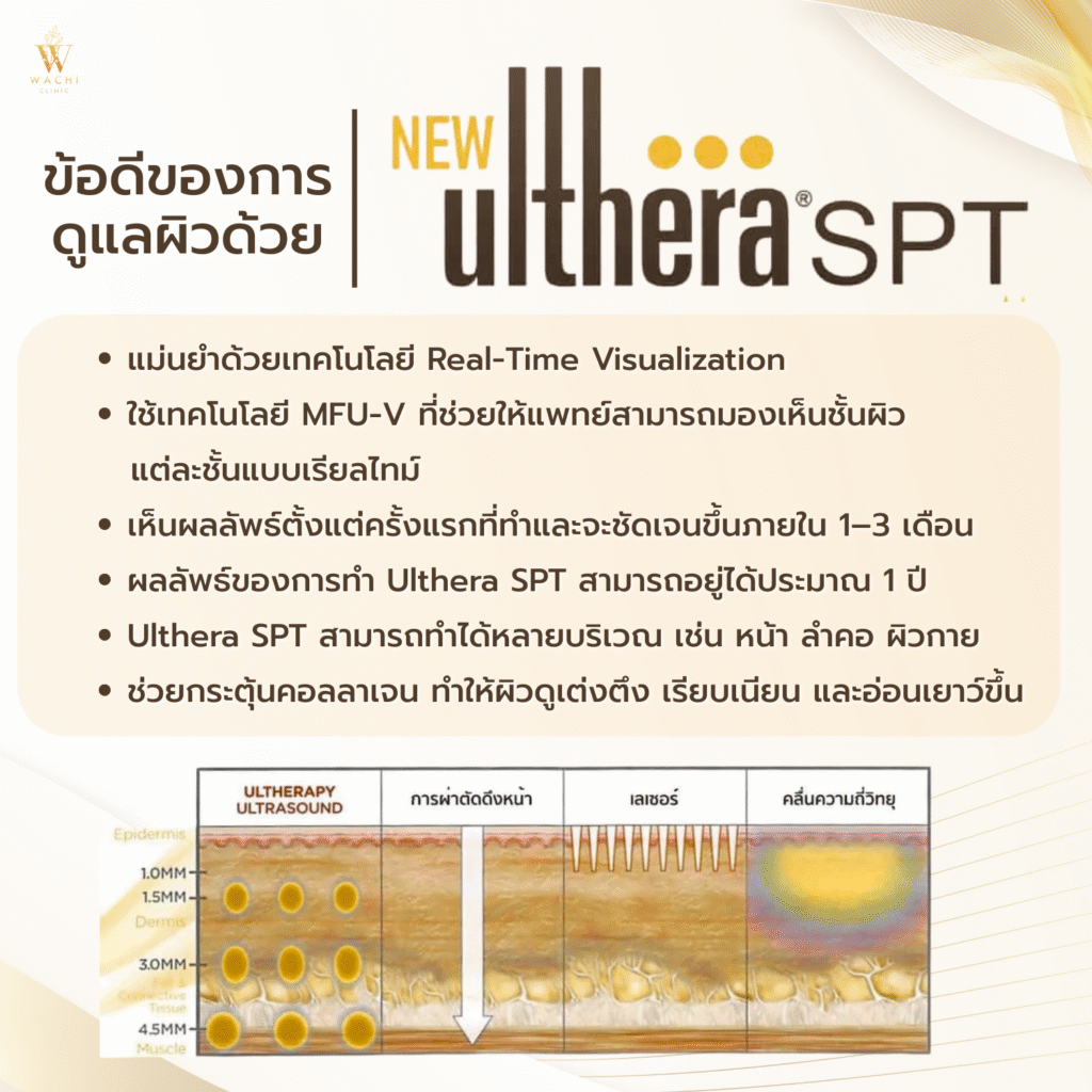 ข้อดีการทำ ulthera