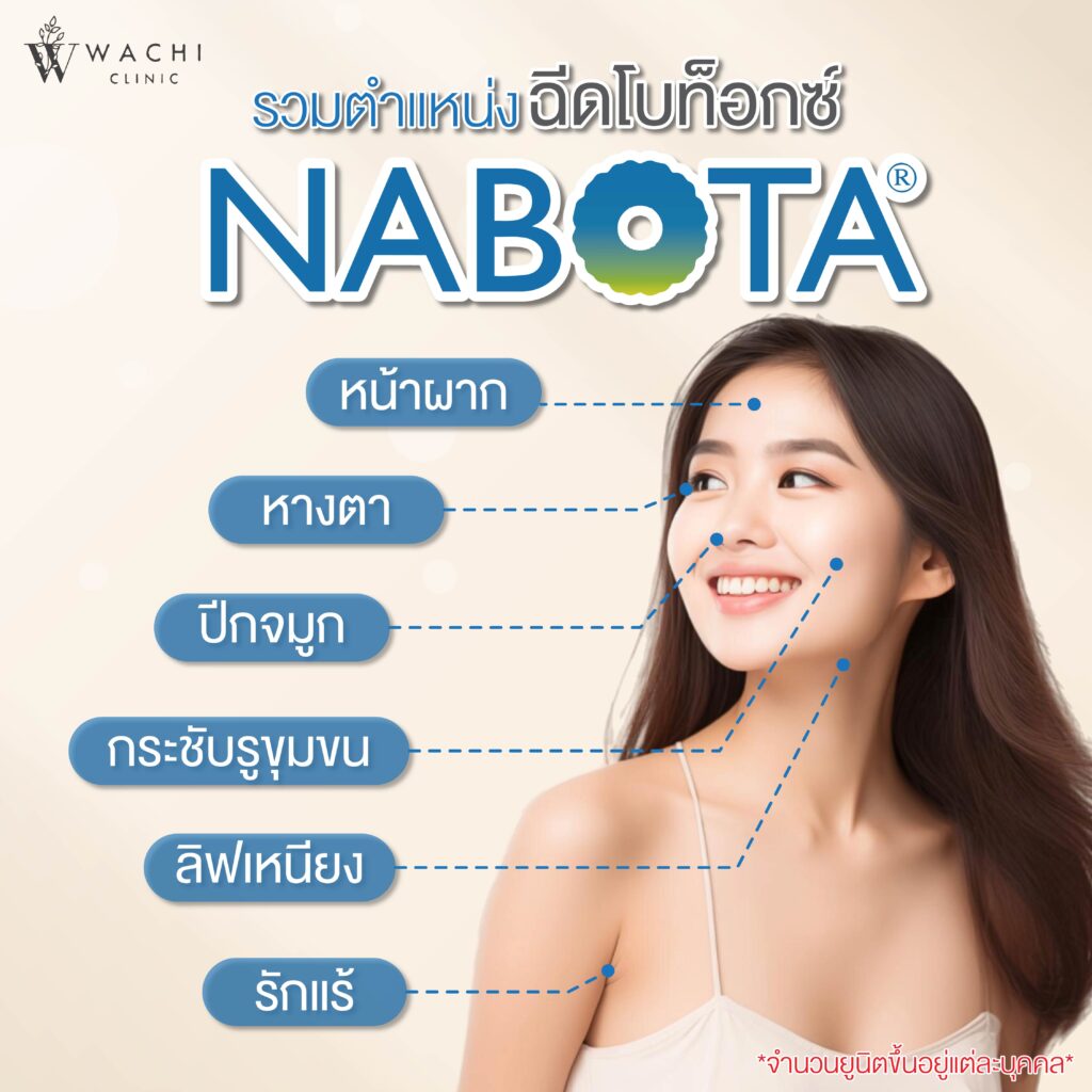 โบท็อกซ์ ฉีดตรงไหนได้บ้าง