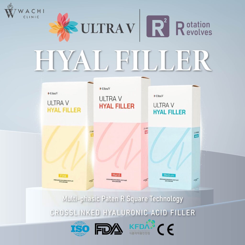 Ultra V Hyal Filler