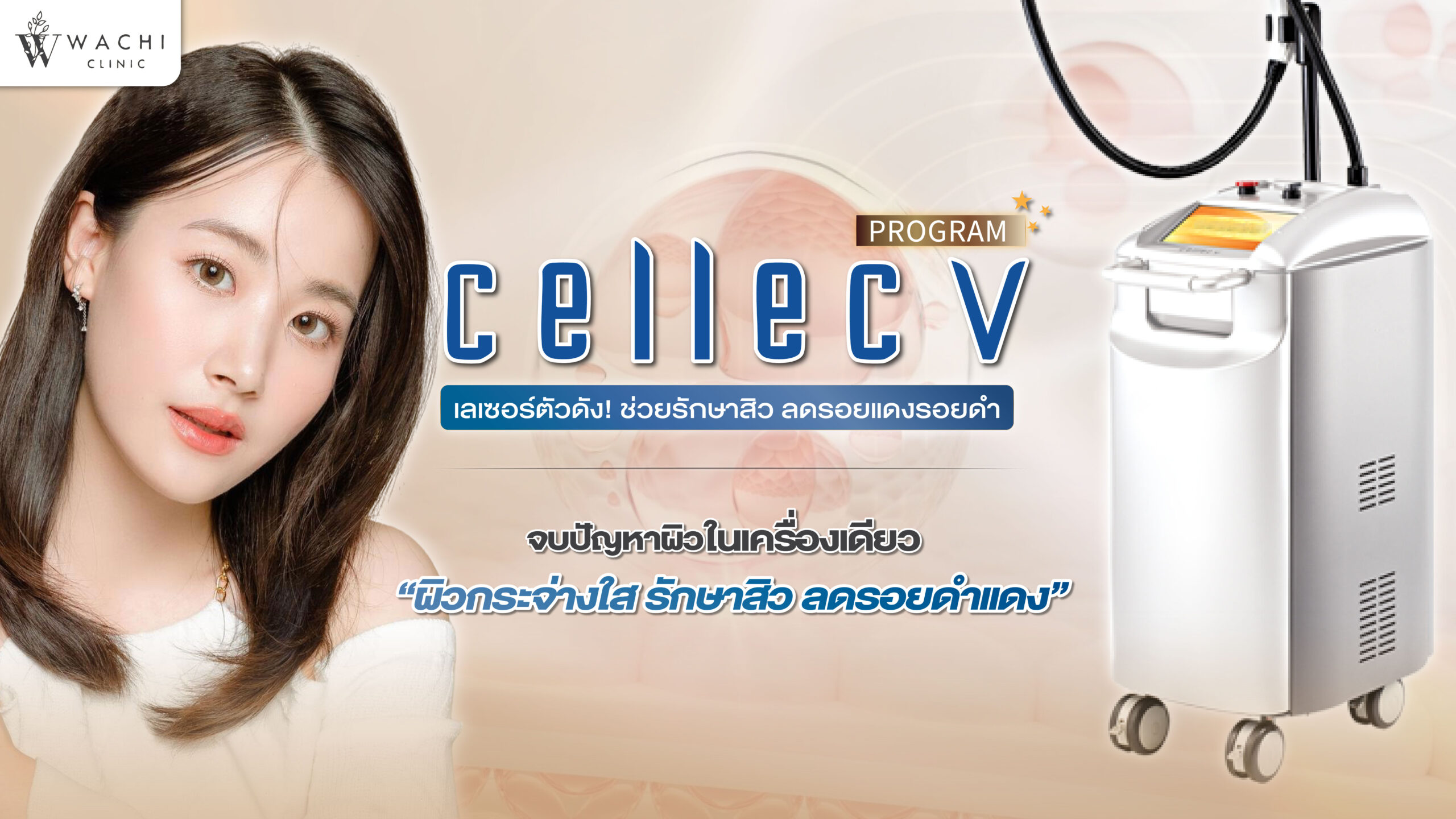 Cellec v