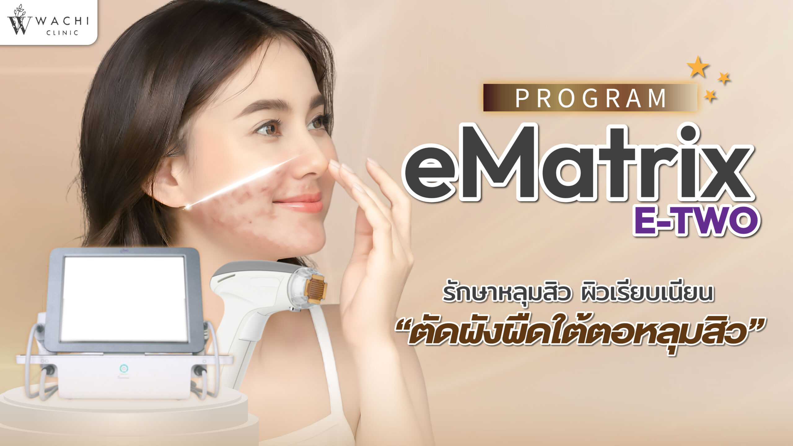 E-matrix E2