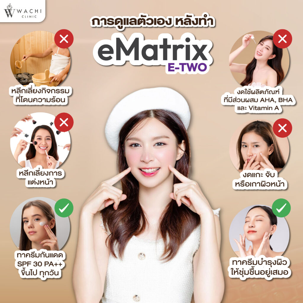การดูแลหลังทำ E Martrix ETWO