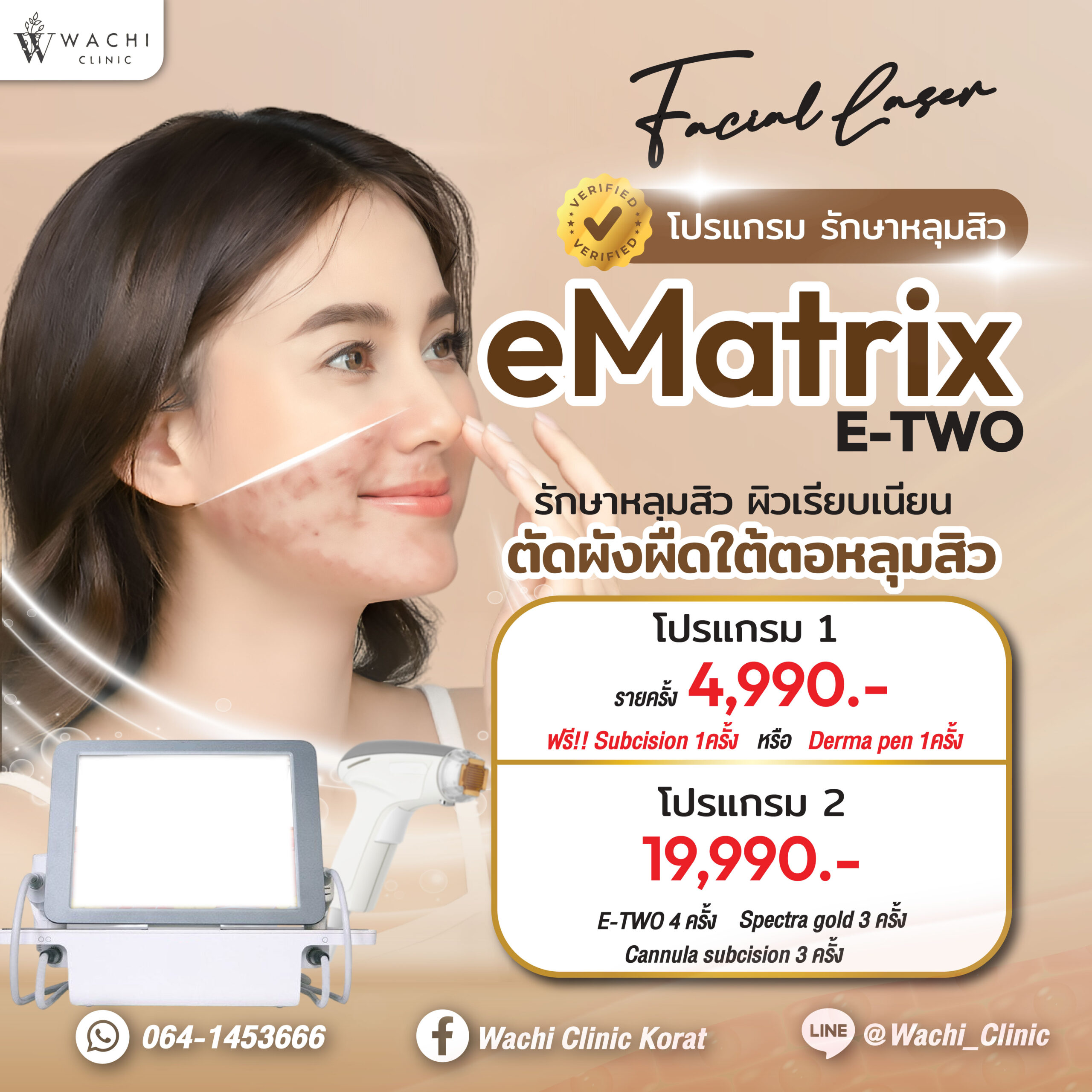 ราคา eMatrix