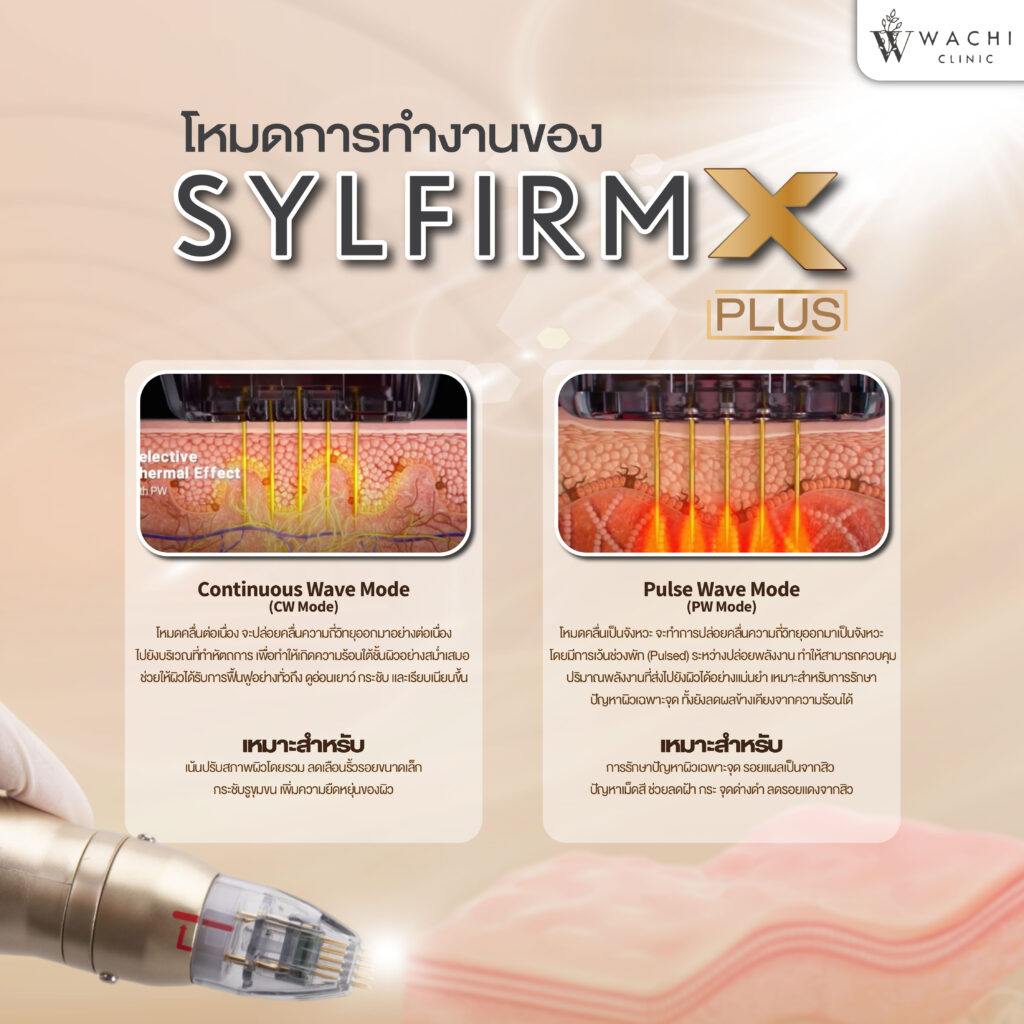 2 โหมดการทำงานของ Sylfirm x Plus ที่ได้รับความนิยม