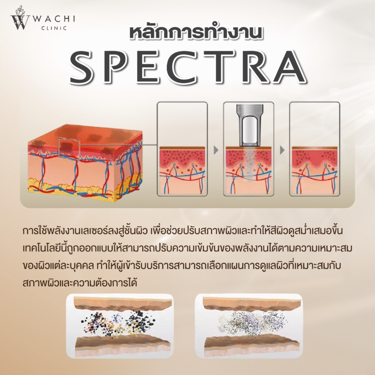 การทำงานของเลเซอร์