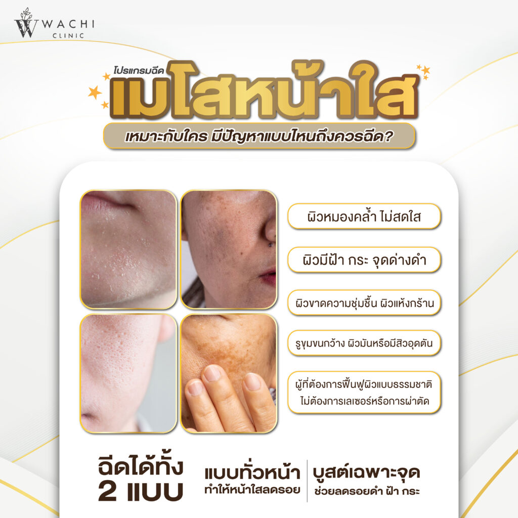 เมโสเหมาะกับใคร