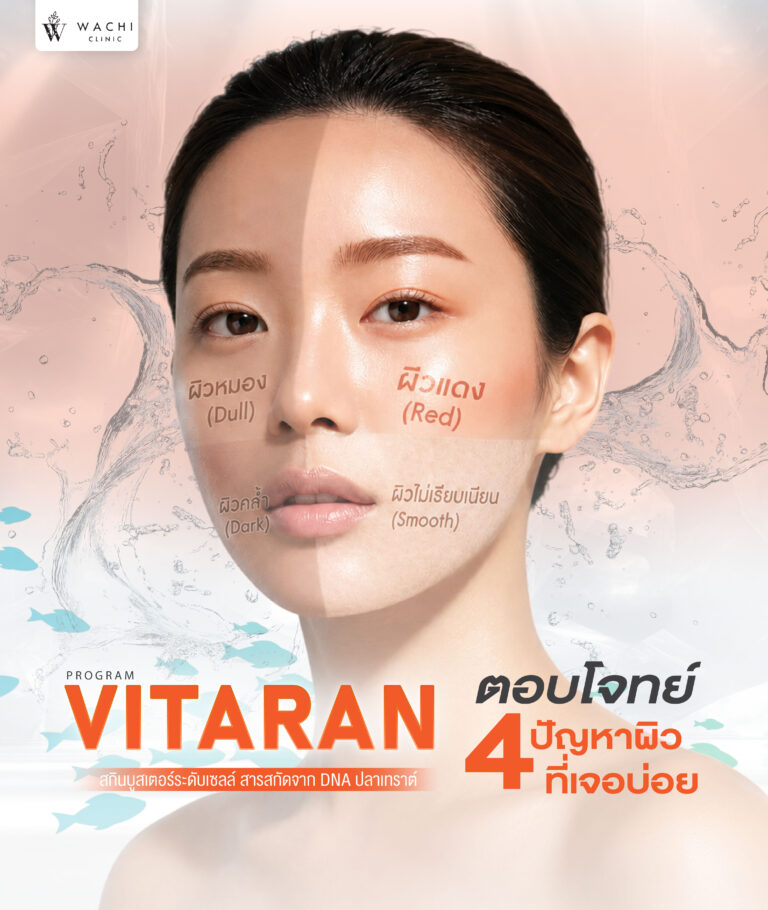 Vitaran เหมาะกับใคร