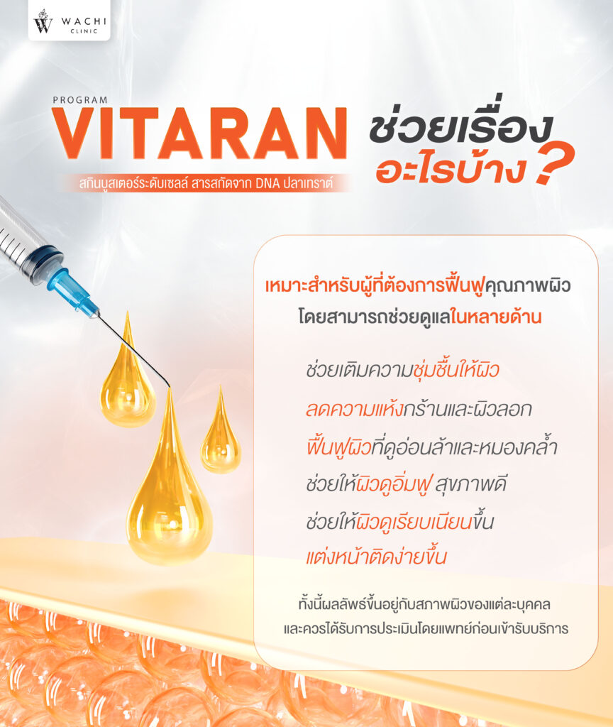 vitaran ช่วยอะไร