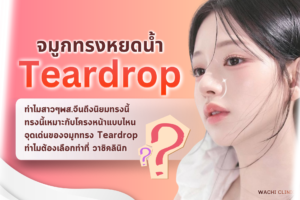 เสริมจมูกทรงหยดน้ำ แบบเกาหลี ราคาเท่าไหร่ รีวิวจริง