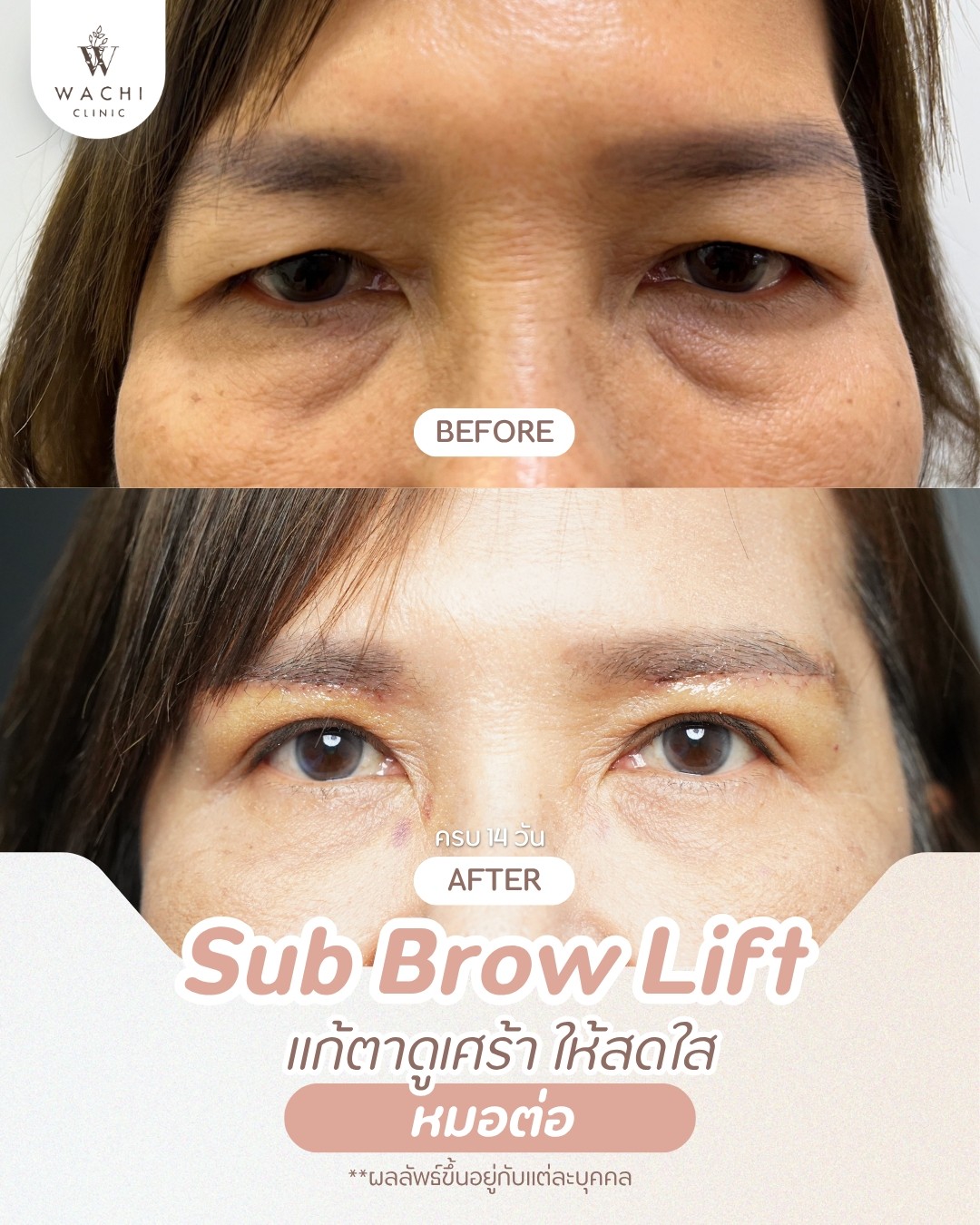 รีวิววาชิคลินิก 10