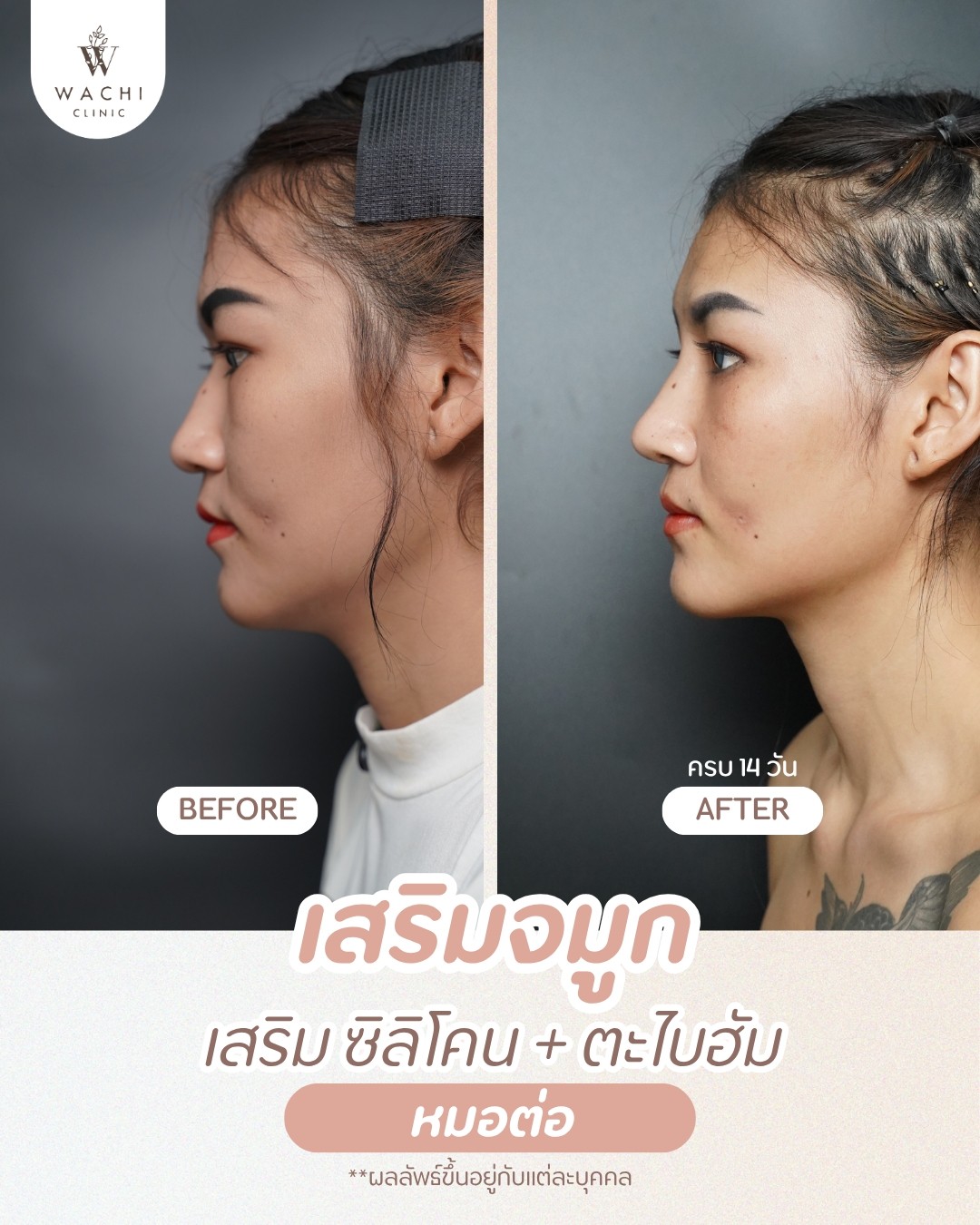 รีวิววาชิคลินิก 12