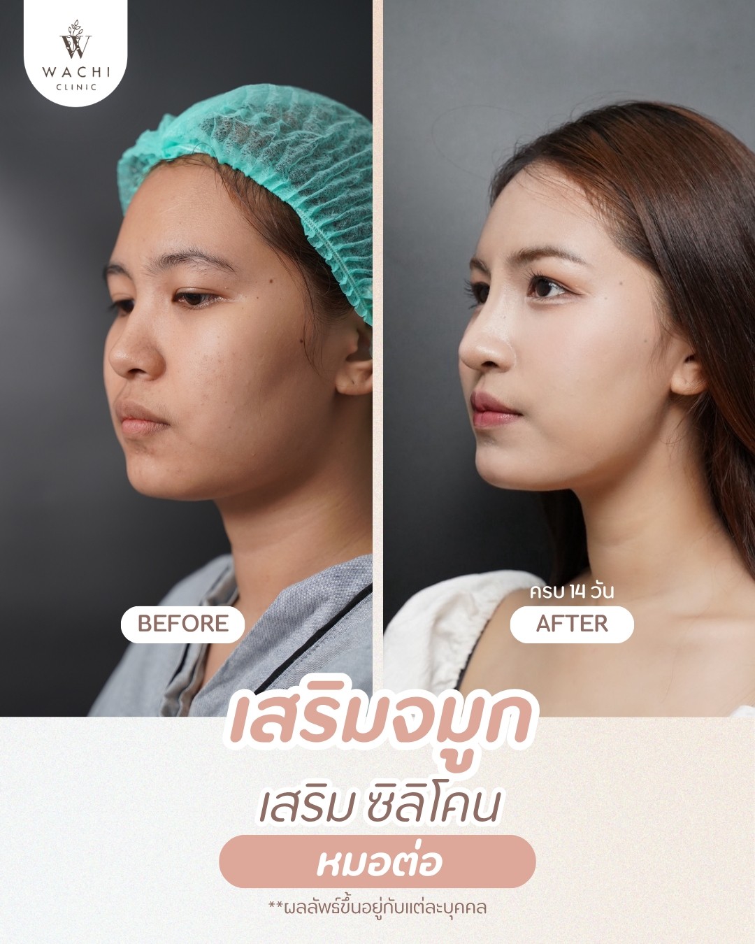 รีวิววาชิคลินิก 16