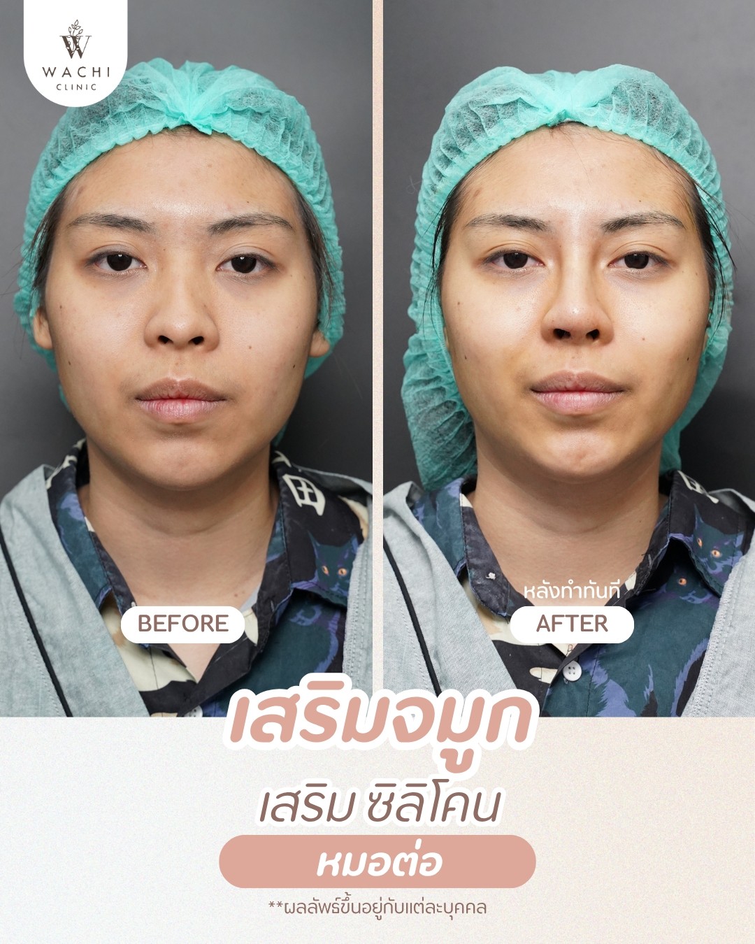 รีวิววาชิคลินิก 18