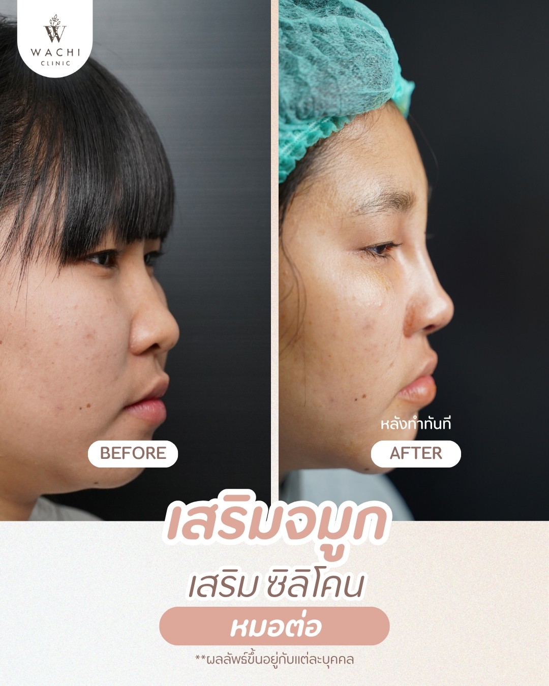 รีวิววาชิคลินิก 2