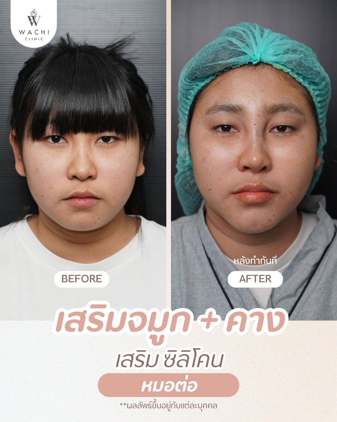 รีวิววาชิคลินิก 24
