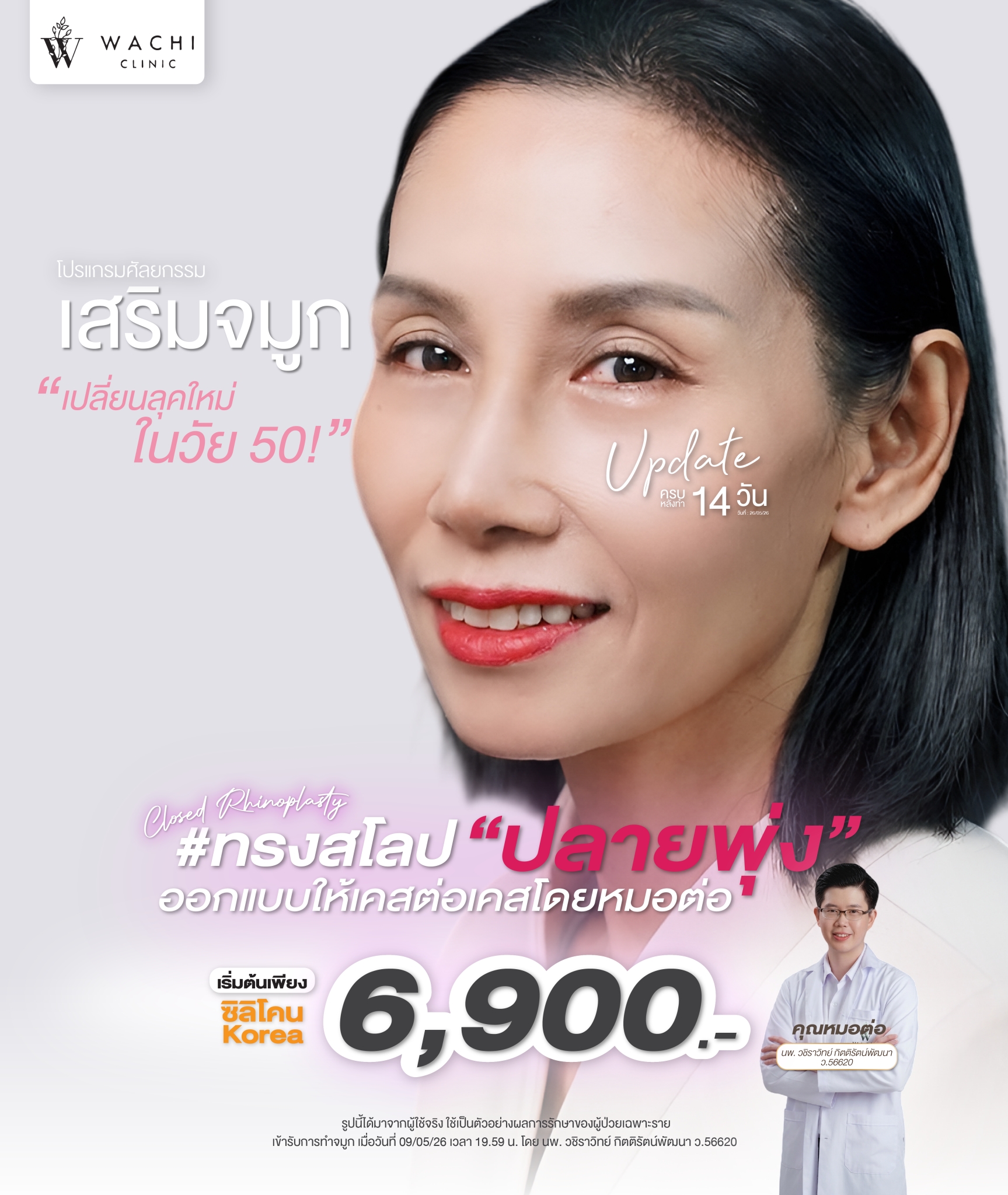 รีวิววาชิคลินิก 26