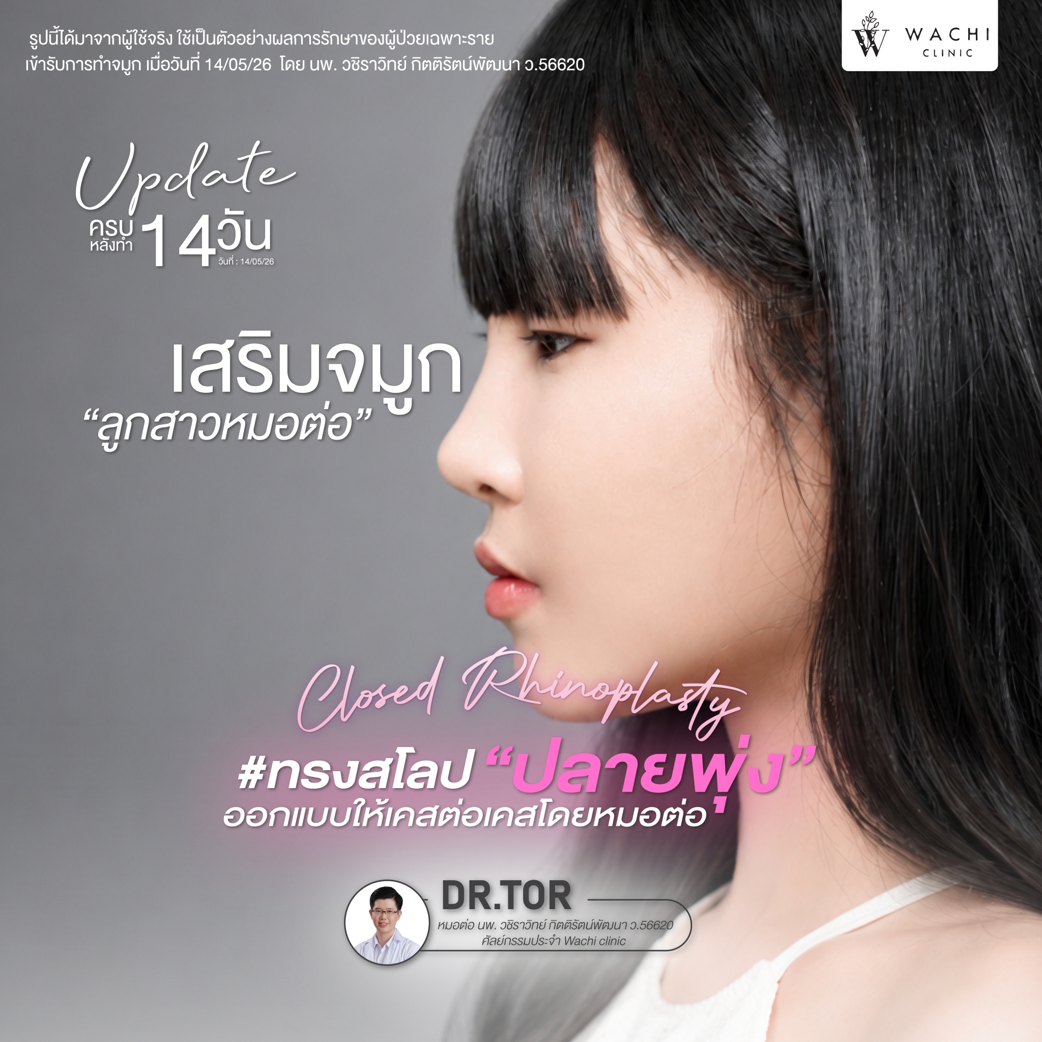 รีวิววาชิคลินิก 27
