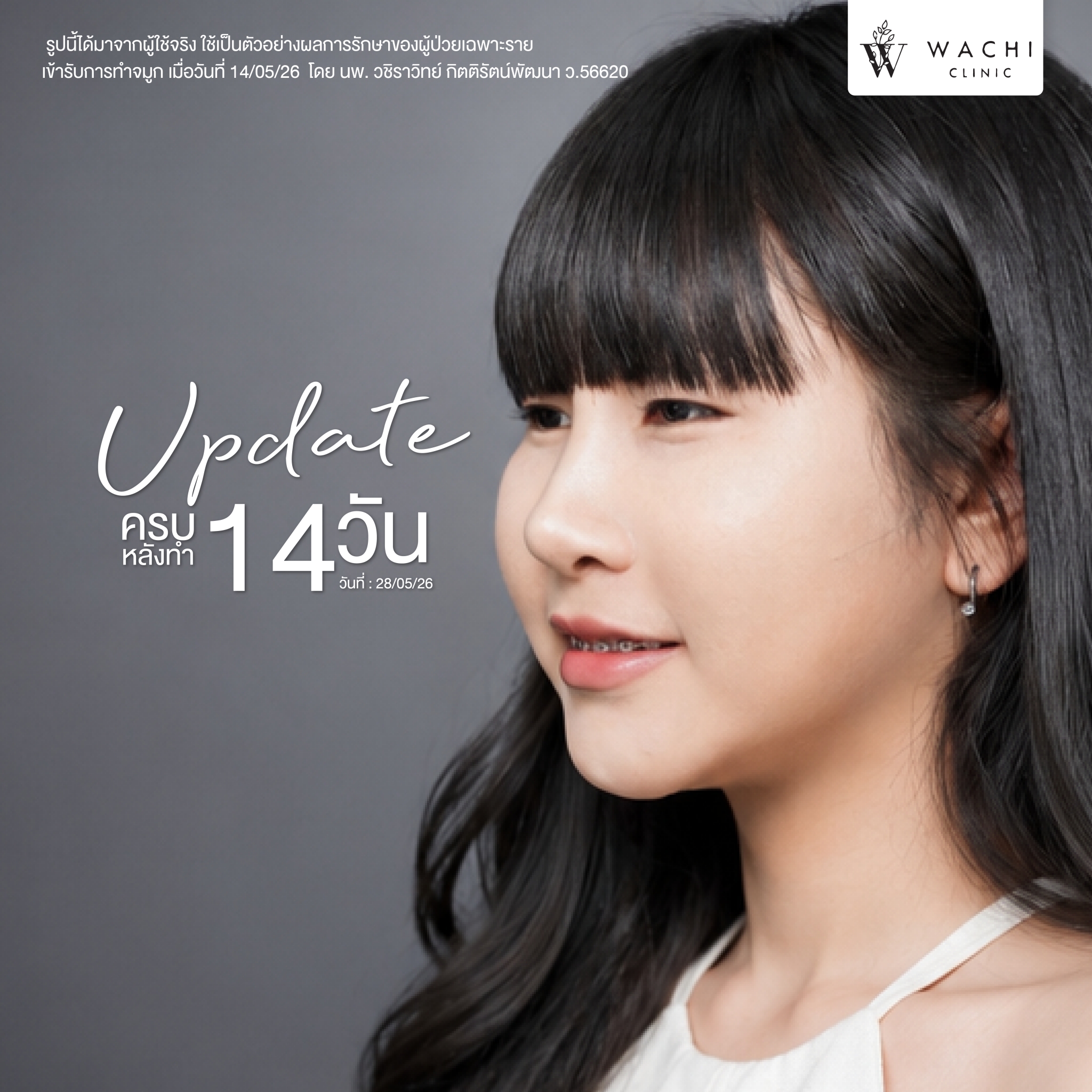 รีวิววาชิคลินิก 28