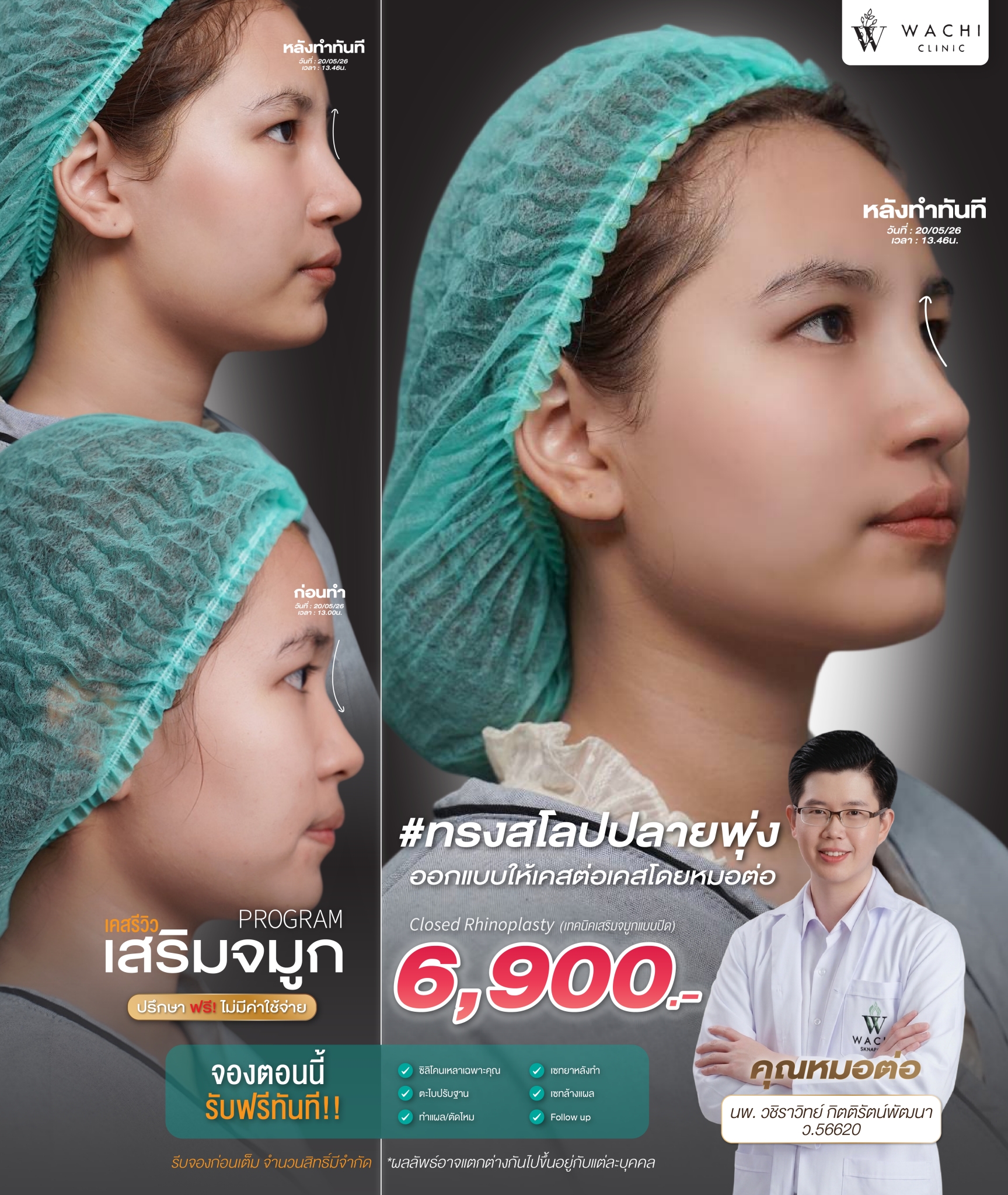 รีวิววาชิคลินิก 29