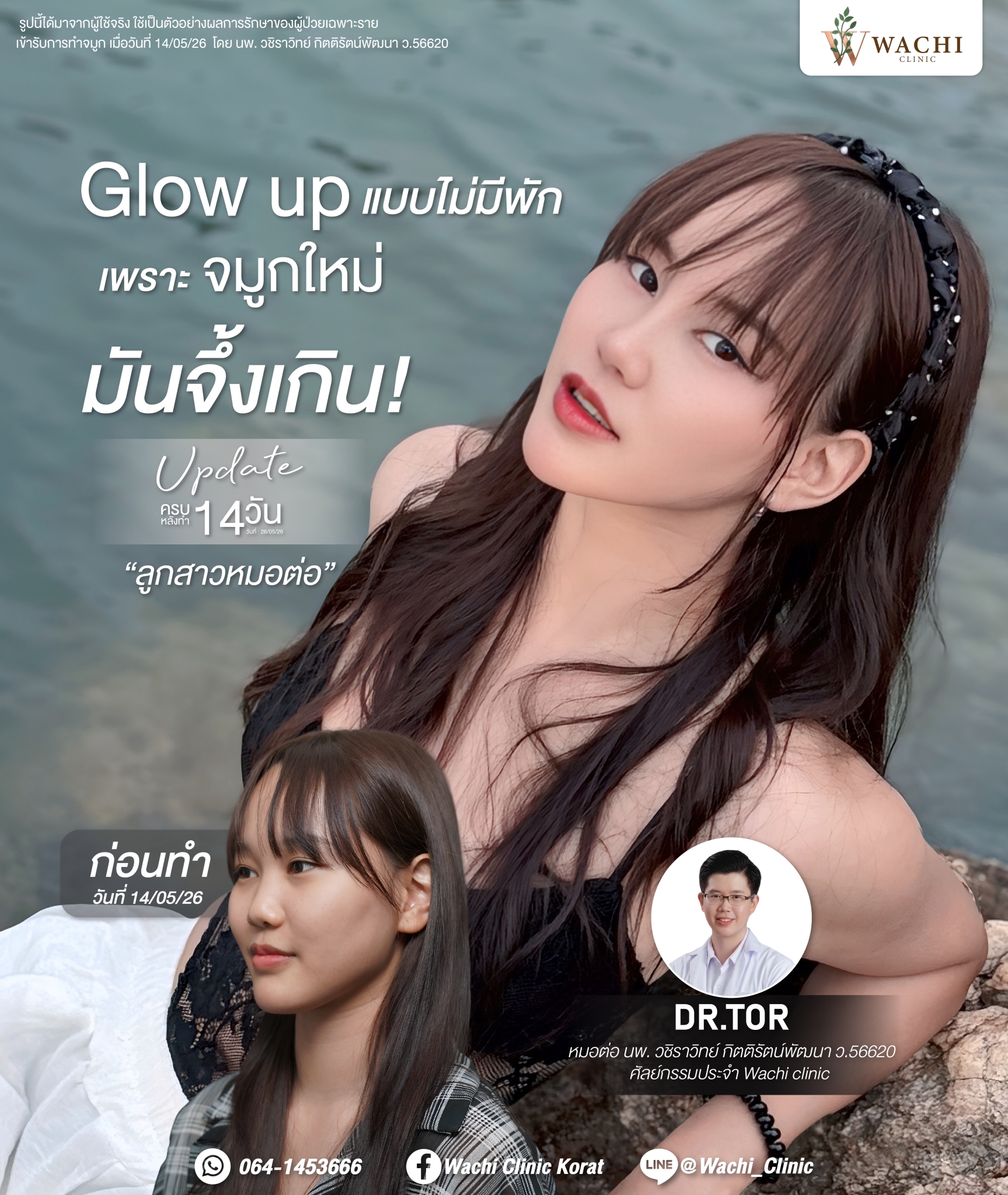 รีวิววาชิคลินิก 31
