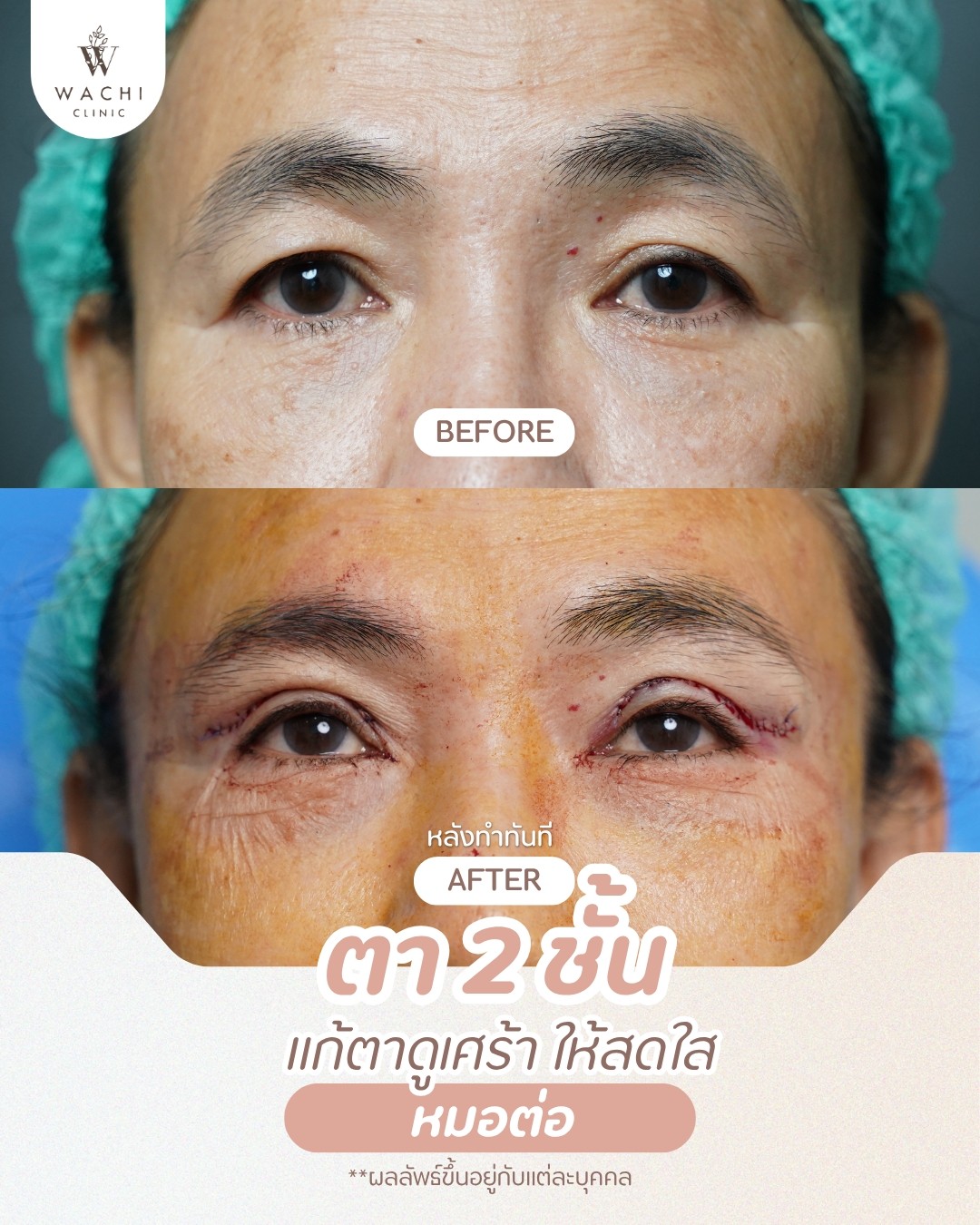 รีวิววาชิคลินิก 8