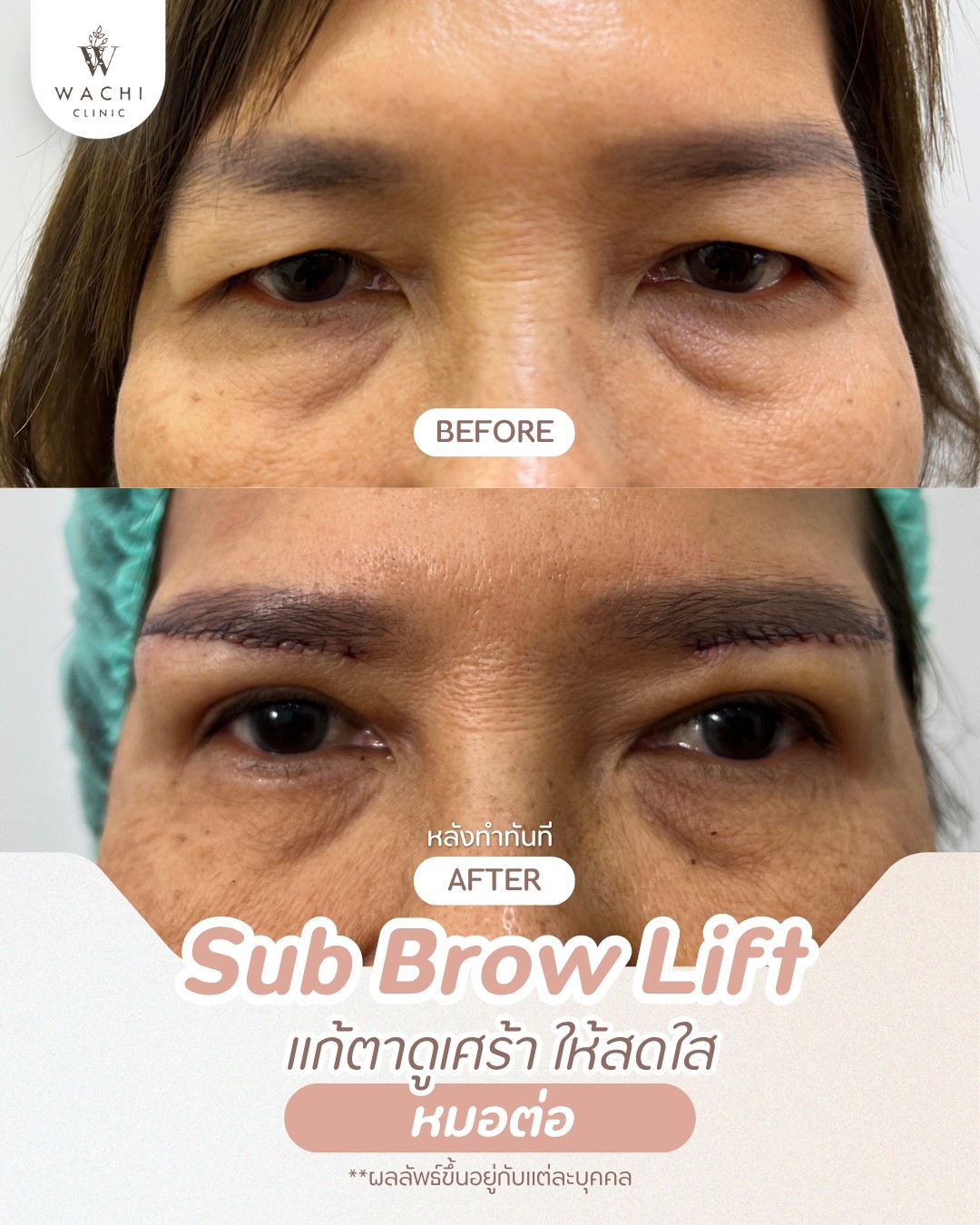 รีวิววาชิคลินิก 9