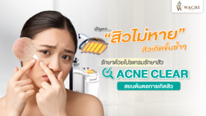 โปรแกรมรักษาสิว | รักษาสิวโคราช ที่ Wachi Clinic