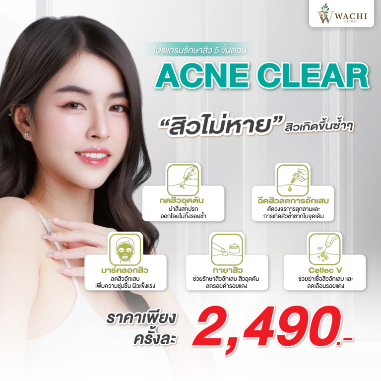กดสิว