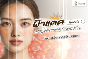 ฝ้าแดด คืออะไร? สาเหตุ รักษาฝ้า และป้องกัน | Wachi Clinic