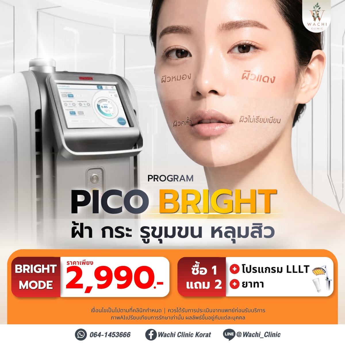 LINE_ALBUM_ADS_BANNER_260901_10