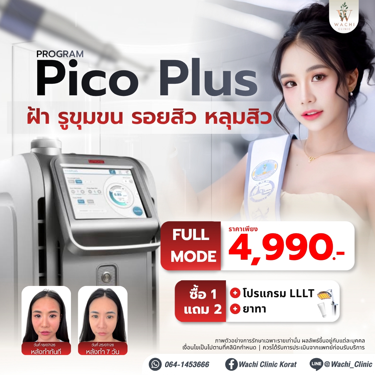 LINE_ALBUM_ADS_BANNER_260901_11