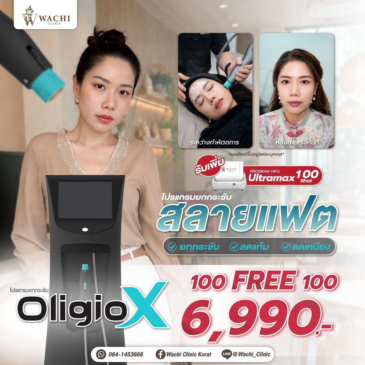 LINE_ALBUM_ADS_BANNER_260901_12