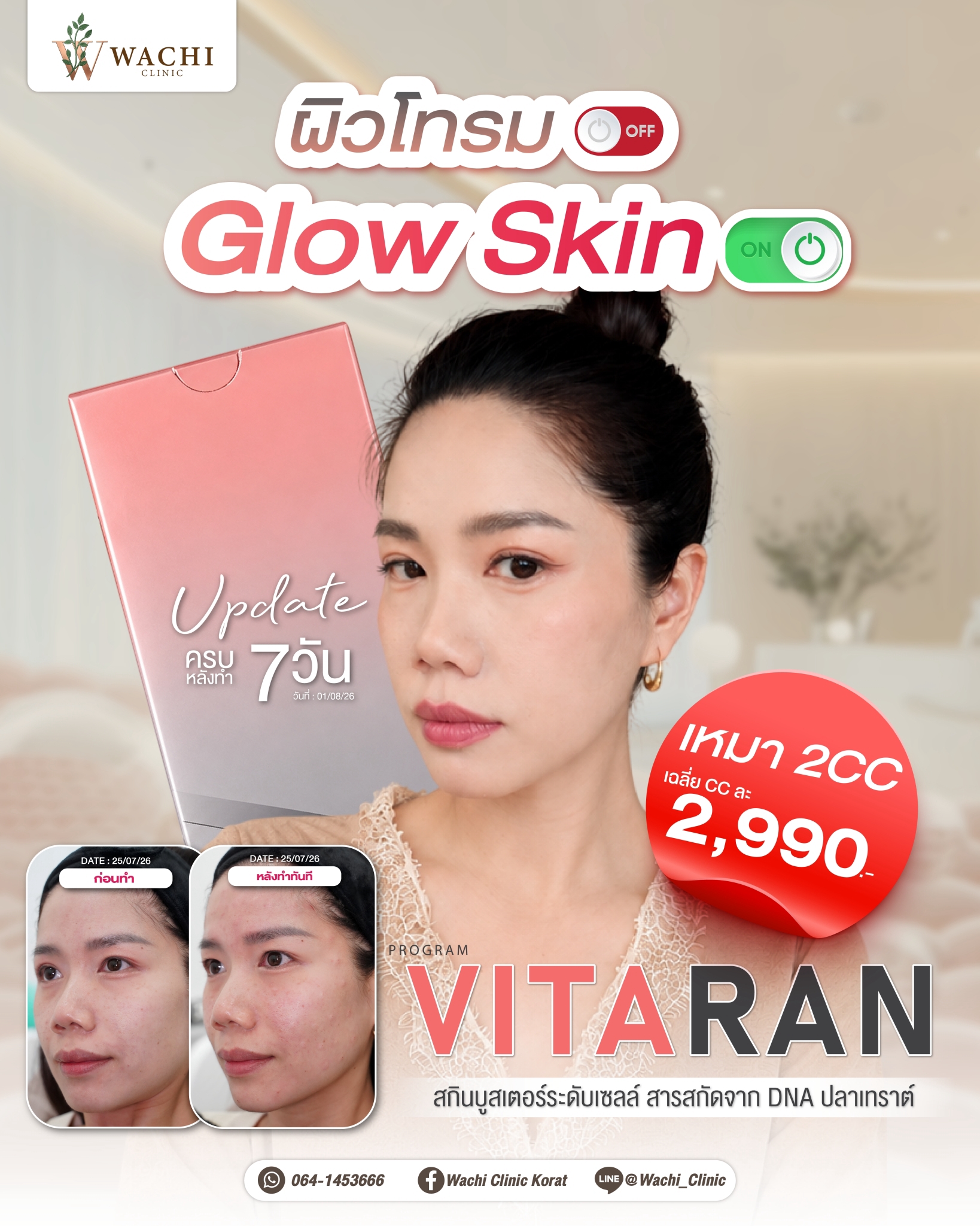LINE_ALBUM_ADS_BANNER_260901_13