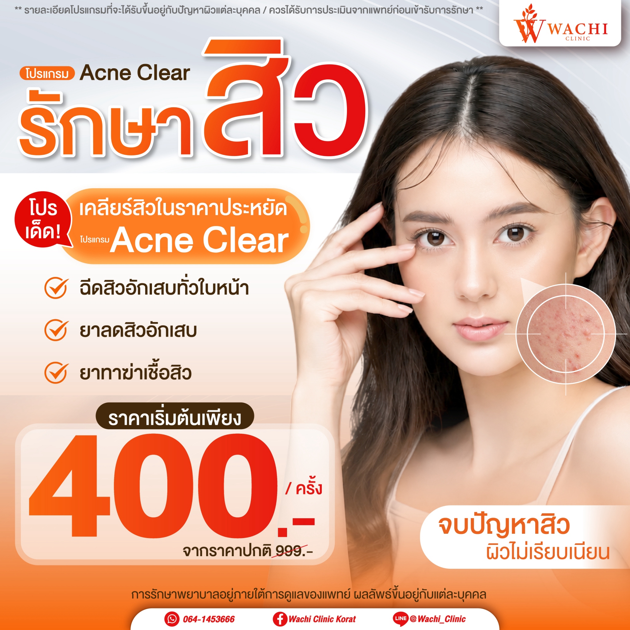 LINE_ALBUM_ADS_BANNER_260901_14