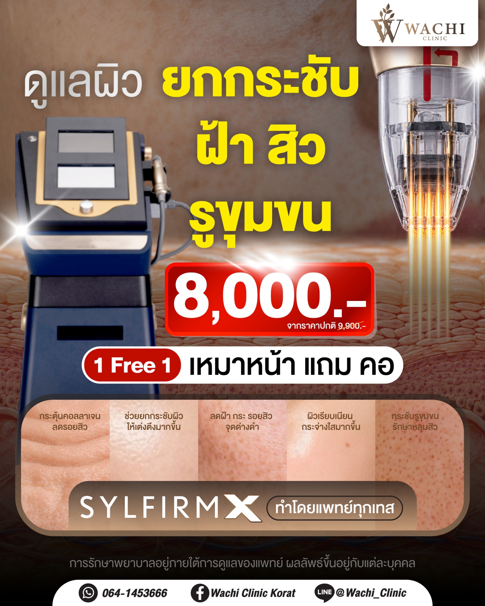 LINE_ALBUM_ADS_BANNER_260901_3
