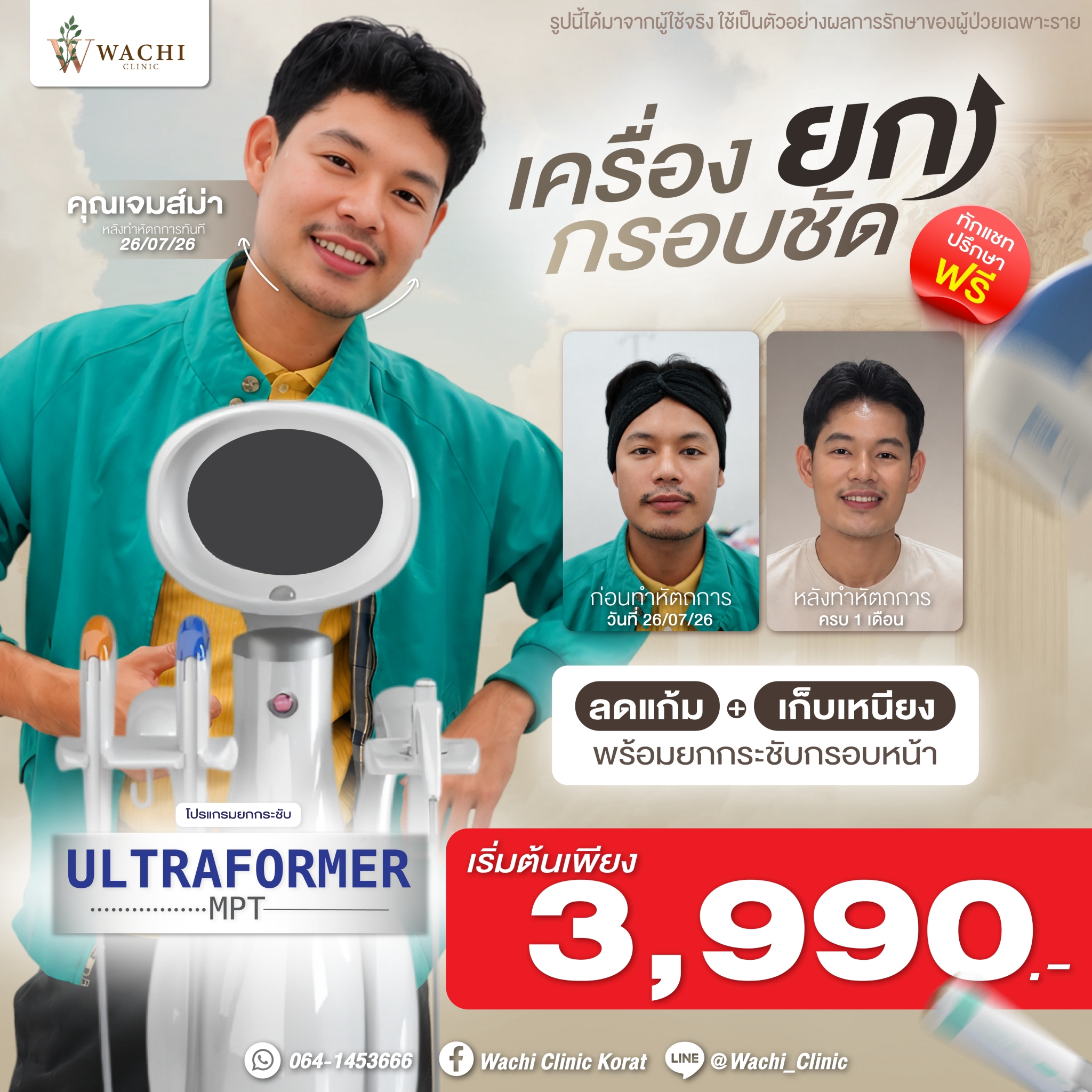 LINE_ALBUM_ADS_BANNER_260901_7