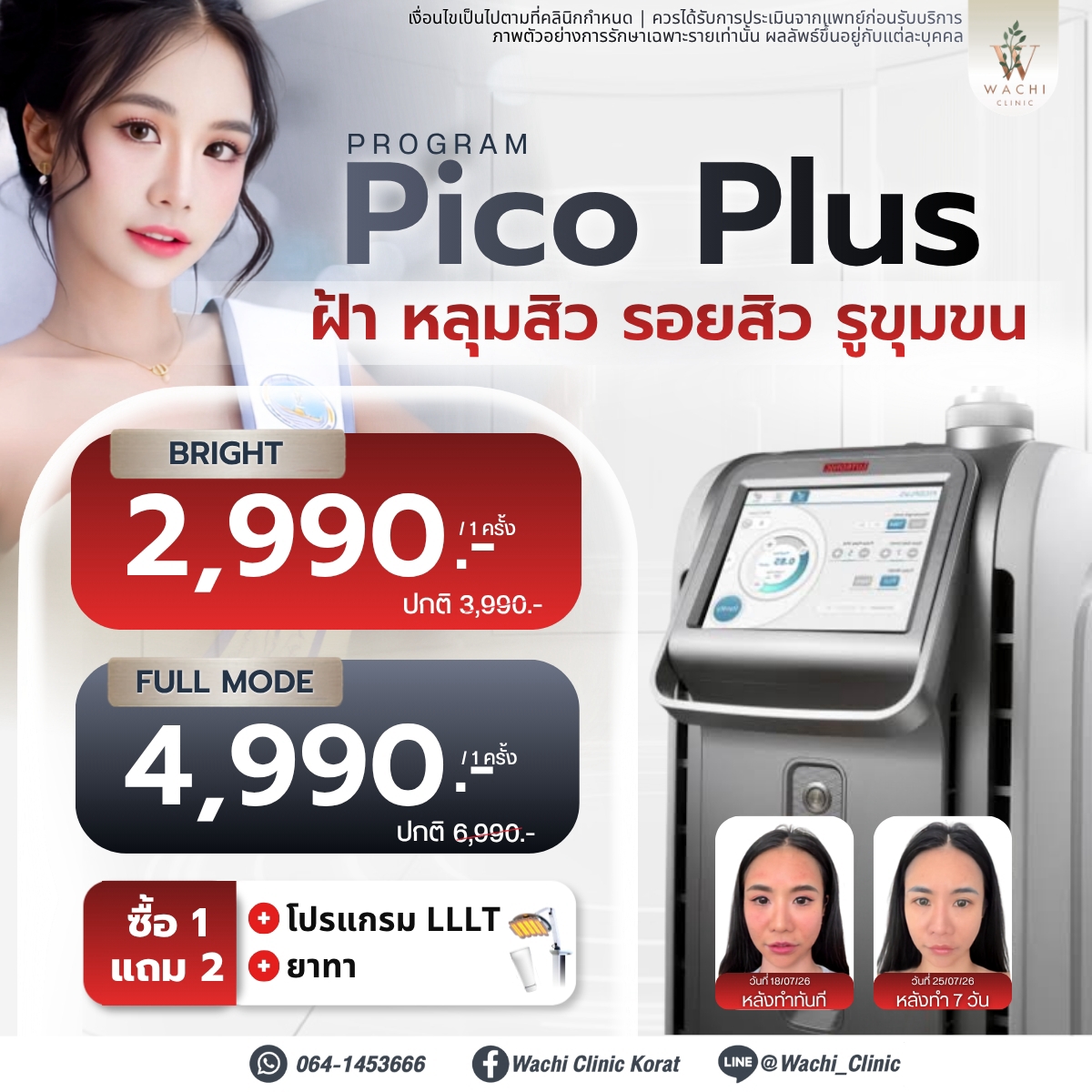 LINE_ALBUM_ADS_BANNER_260901_9