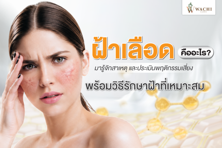 ฝ้าเลือดคืออะไร