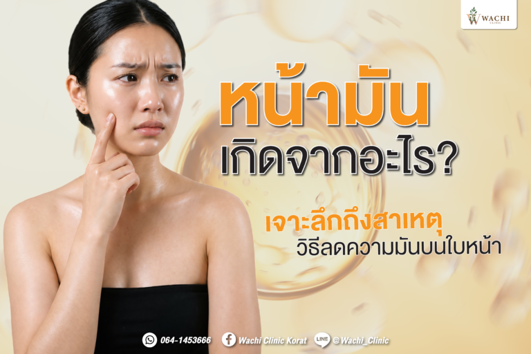 หน้ามันเกิดจากอะไร
