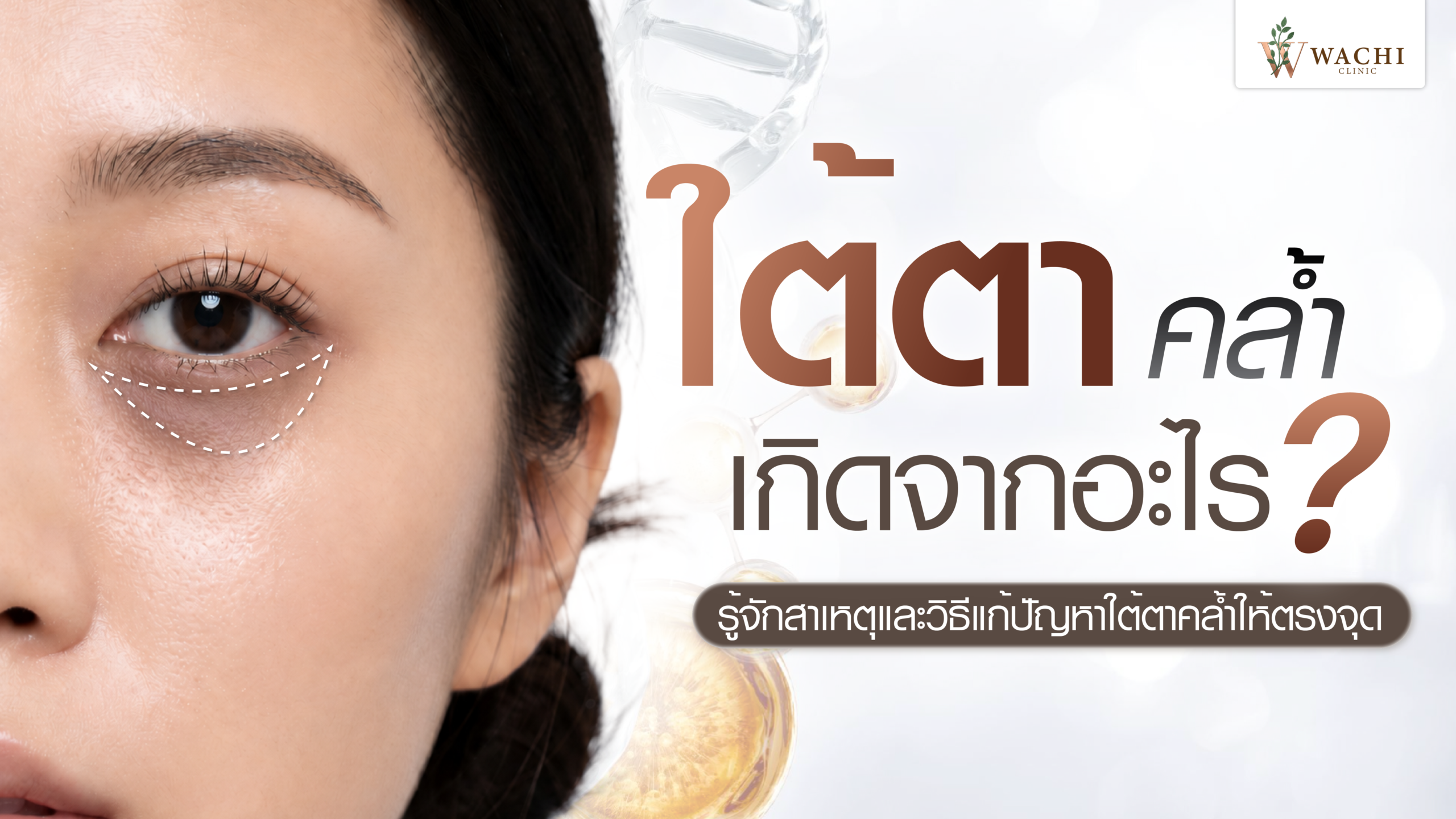 ใต้ตาคล้ำ