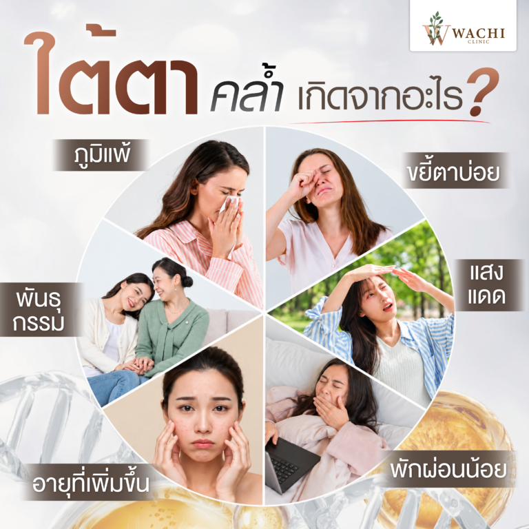 ใต้ตาดำคล้ำ เกิดจากอะไร