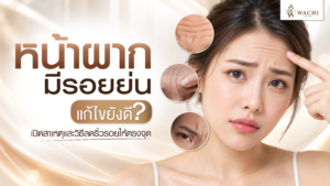 หน้าผากมีรอยย่น แก้ยังไงดี? สาเหตุและวิธีลดริ้วรอย